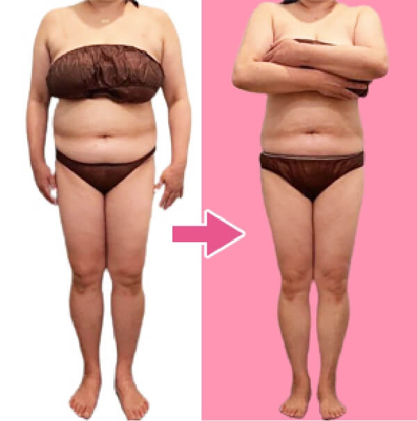 BEFORE AFTER1