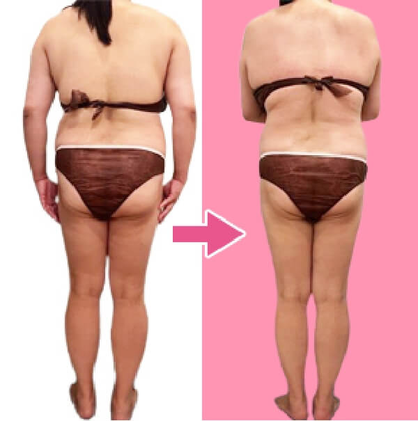 BEFORE AFTER3