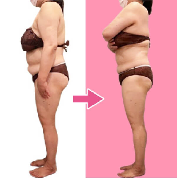 BEFORE AFTER2